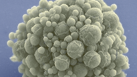 In 2016, scientists created synthetic bacteria with just 473 genes. (JCVI-syn3.0. Image: J. Craig Venter Institute)